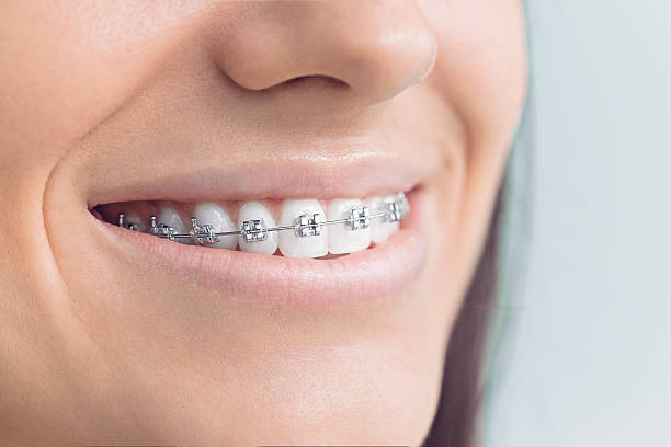 Best Dental Inlays and Onlays  in Santa Rosa, NM